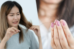 Balding Must-Know: The Four Hair Growth Phases