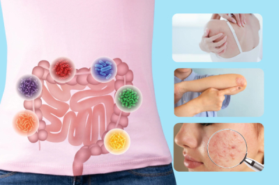 Can Probiotics Malaysia Help With Skin Problems | Bai Zi Gui