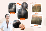 Complete TCM Guide to Hair Loss Regulation: Fundamentally Improve Thinning Hair and Scalp Health