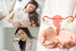 PCOS and Irregular Periods: How Traditional Chinese Medicine (TCM) Can Restore Your Menstrual Cycle Naturally