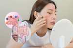 皮肤敏感与湿疹的内调之道：益生菌如何发挥关键修复作用？