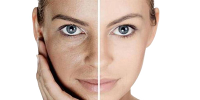 Six Key Signs of Hormonal Imbalance in Women - Bai Zi Gui
