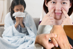 Siapa yang Paling Mudah Terkena Influenza? I Bai Zi Gui